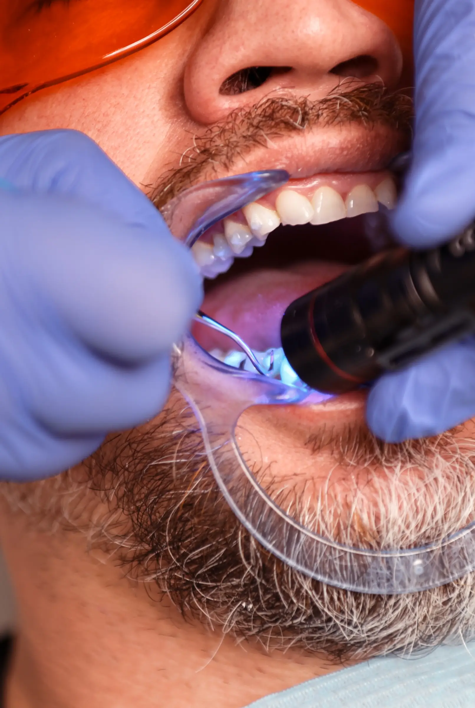 Hey Marketing_Case_Felix bellus_Sfeerbeeld_Behandeling